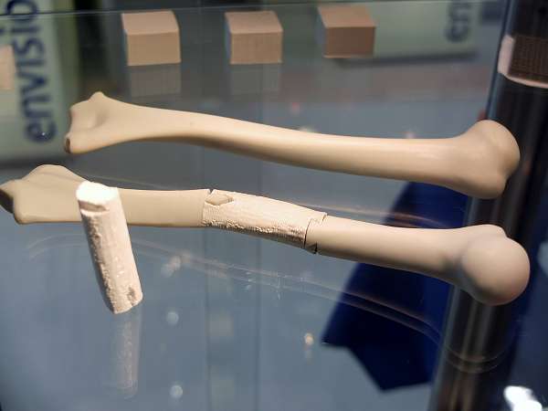 3D bioprinten