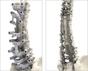 Op de linker foto zijn de geleidingen goed zichtbaar (foto 3D Systems)