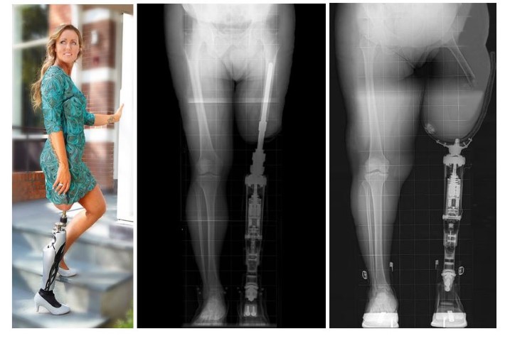 Click Safety Adapter