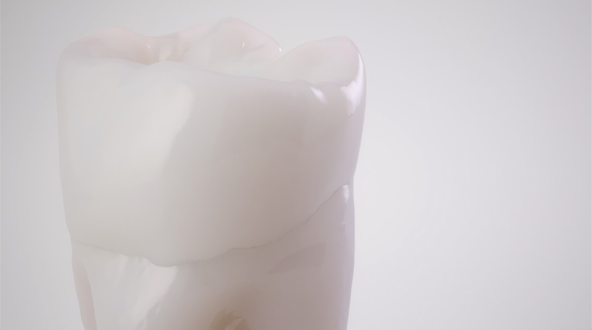 Flexcera Smile Ultra