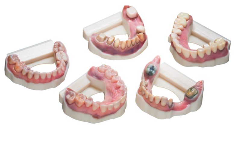 dental